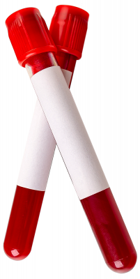 blood-test-tube-2021-04-03-19-37-57-utc-small